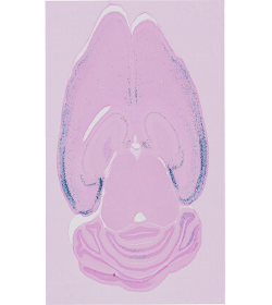 Nop_tta_raw_s019.png